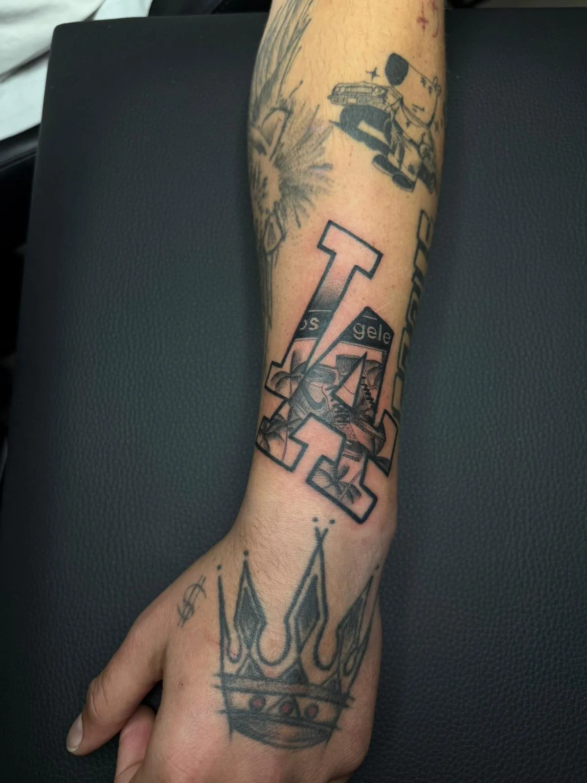 Collage · Forearm